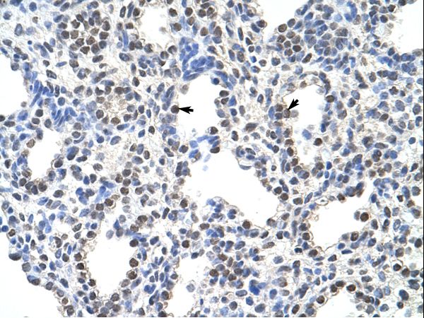 SRSF10 / FUSIP1 Antibody - SRSF10 / FUSIP1 antibody ARP41082_P050-NP_473357-FUSIP1 (FUS interacting protein (serine/arginine-rich) 1) Antibody was used in IHC to stain formalin-fixed, paraffin-embedded human lung.  This image was taken for the unconjugated form of this product. Other forms have not been tested.
