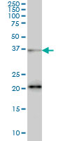 SRSF10 / FUSIP1 Antibody - FUSIP1 monoclonal antibody (M03), clone 1A6 Western blot of FUSIP1 expression in HeLa NE.
