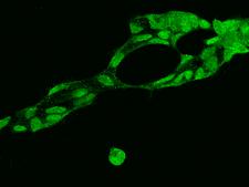 SRSF10 / FUSIP1 Antibody - Immunofluorescence staining of SRSF10 in HEK293 cells. Cells were fixed with 4% PFA, permeabilzed with 0.1% Triton X-100 in PBS, blocked with 10% serum, and incubated with rabbit anti-Human SRSF10 polyclonal antibody (dilution ratio 1:200) at 4°C overnight. Then cells were stained with the Alexa Fluor 488-conjugated Goat Anti-rabbit IgG secondary antibody (green). Positive staining was localized to Nucleus.