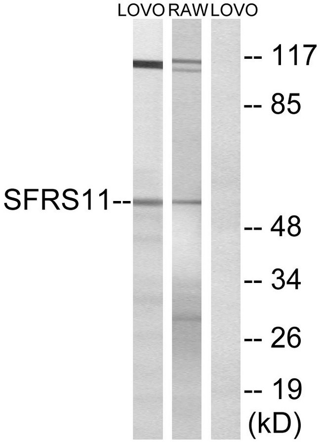 SRSF11 / SFRS11 Antibody - Western blot analysis of lysates from LOVO and RAW264.7 cells, using SFRS11 Antibody. The lane on the right is blocked with the synthesized peptide.