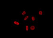 SRSF11 / SFRS11 Antibody - Staining LOVO cells by IF/ICC. The samples were fixed with PFA and permeabilized in 0.1% Triton X-100, then blocked in 10% serum for 45 min at 25°C. The primary antibody was diluted at 1:200 and incubated with the sample for 1 hour at 37°C. An Alexa Fluor 594 conjugated goat anti-rabbit IgG (H+L) Ab, diluted at 1/600, was used as the secondary antibody.