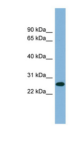 SRSF12 Antibody - SRSF12 / SFRS13B antibody Western blot of PANC1 cell lysate. This image was taken for the unconjugated form of this product. Other forms have not been tested.