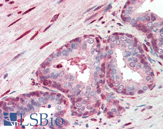 SRSF2 / SC35 Antibody - Anti-SRSF2 / SC35 antibody IHC staining of human prostate. Immunohistochemistry of formalin-fixed, paraffin-embedded tissue after heat-induced antigen retrieval. Antibody concentration 10 ug/ml.  This image was taken for the unconjugated form of this product. Other forms have not been tested.