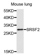 SRSF2 / SC35 Antibody - Western blot analysis of extracts of mouse lung cells.
