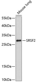 SRSF2 / SC35 Antibody - Western blot analysis of extracts of mouse lung using SRSF2 Polyclonal Antibody at dilution of 1:1000.