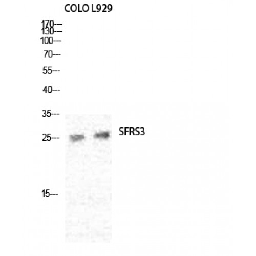 SRSF3 / SRP20 Antibody - Western blot of SRp20 antibody