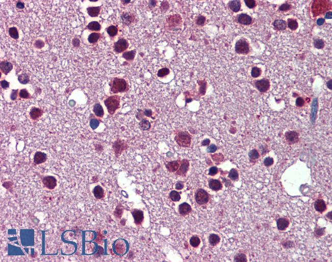 SRSF3 / SRP20 Antibody - Anti-SRSF3 / SFRS3 antibody IHC of human brain, cortex. Immunohistochemistry of formalin-fixed, paraffin-embedded tissue after heat-induced antigen retrieval. Antibody concentration 5 ug/ml.  This image was taken for the unconjugated form of this product. Other forms have not been tested.