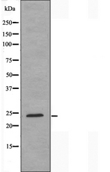 SRSF3 / SRP20 Antibody - Western blot analysis of extracts of HeLa cells using SFRS3 antibody.