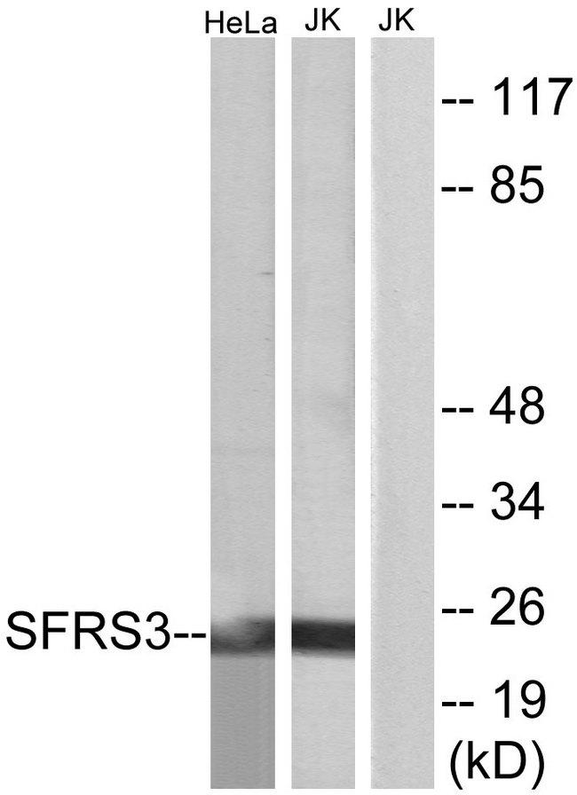 SRSF3 / SRP20 Antibody - Western blot analysis of extracts from HeLa cells and Jurkat cells, using SFRS3 antibody.