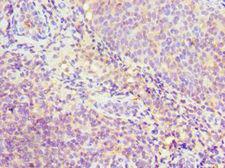 SRSF4 / SFRS4 Antibody - Immunohistochemistry of paraffin-embedded human tonsil using antibody at 1:100 dilution.