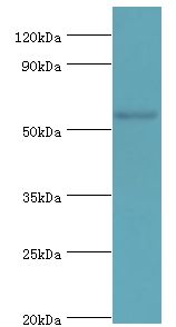 SRSF4 / SFRS4 Antibody - Western blot. All lanes: Serine/arginine-rich splicing factor 4 antibody at 4 ug/ml+HeLa whole cell lysate. Secondary antibody: Goat polyclonal to rabbit at 1:10000 dilution. Predicted band size: 57 kDa. Observed band size: 57 kDa Immunohistochemistry.