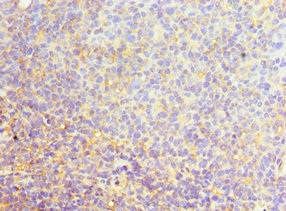 SRSF4 / SFRS4 Antibody - Immunohistochemistry of paraffin-embedded human tonsil tissue using SRSF4 Antibody at dilution of 1:100