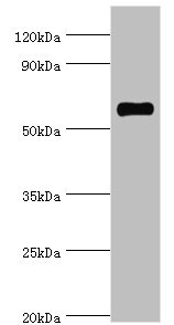 SRSF4 / SFRS4 Antibody - Western blot All lanes: SRSF4 antibody at 4µg/ml + Hela whole cell lysate Secondary Goat polyclonal to rabbit IgG at 1/10000 dilution Predicted band size: 57 kDa Observed band size: 57 kDa