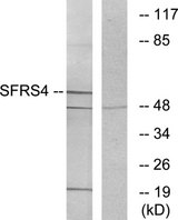 SRSF4 / SFRS4 Antibody - Western blot analysis of lysates from LOVO cells, using SFRS4 Antibody. The lane on the right is blocked with the synthesized peptide.