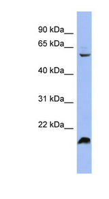 SRSF4 / SFRS4 Antibody - SRSF4 / SFRS4 antibody Western blot of HT1080 cell lysate. This image was taken for the unconjugated form of this product. Other forms have not been tested.
