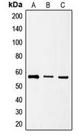 SRSF4 / SFRS4 Antibody - Western blot analysis of SRSF4 expression in HeLa (A); HT1080 (B); NIH3T3 (C) whole cell lysates.
