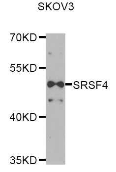 SRSF4 / SFRS4 Antibody - Western blot analysis of extracts of SKOV3 cells.