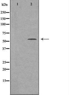SRSF4 / SFRS4 Antibody - Western blot analysis of extracts of LOVO cells using SFRS4 antibody. The lane on the left is treated with the antigen-specific peptide.