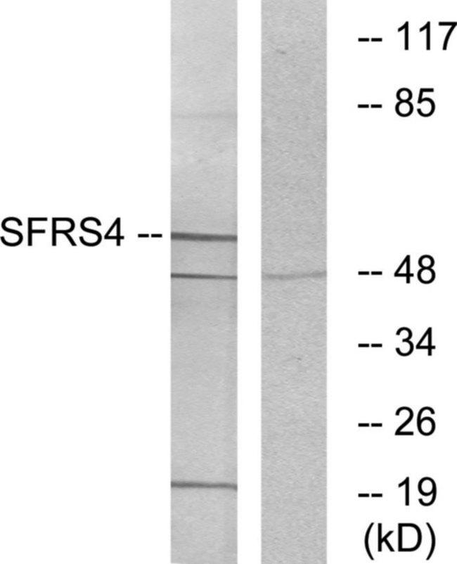 SRSF4 / SFRS4 Antibody - Western blot analysis of extracts from LOVO cells, using SFRS4 antibody.