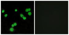 SRSF5 / SFRS5 Antibody - Immunofluorescence analysis of MCF7 cells, using SFRS5 Antibody. The picture on the right is blocked with the synthesized peptide.