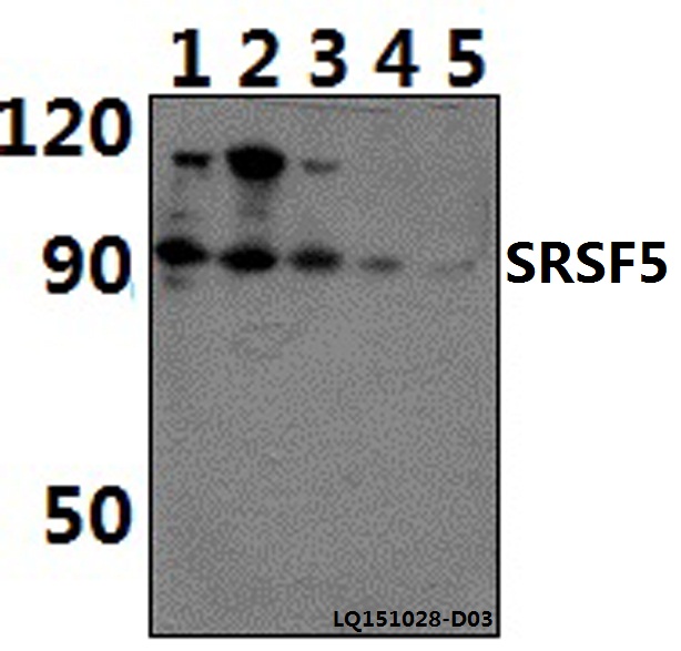 SRSF5 / SFRS5 Antibody - Western blot of SRSF5 polyclonal antibody at 1:500 dilution. Lane 1: RAW264.7 whole cell lysate (40 ug). Lane 2: HeLa whole cell lysate (40 ug). Lane 3: H9C2 whole cell lysate (40 ug). Lane 4: NIH-3T3 whole cell lysate (40 ug). Lane 5: HEK293T whole cell lysate (40.