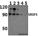SRSF5 / SFRS5 Antibody - Western blot of SRSF5 polyclonal antibody at 1:500 dilution. Lane 1: RAW264.7 whole cell lysate (40 ug). Lane 2: HeLa whole cell lysate (40 ug). Lane 3: H9C2 whole cell lysate (40 ug). Lane 4: NIH-3T3 whole cell lysate (40 ug). Lane 5: HEK293T whole cell lysate (40.