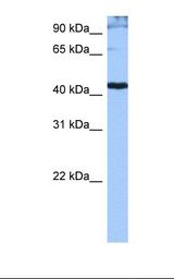 SRSF6 / SRP55 Antibody - Jurkat cell lysate. Antibody concentration: 0.5 ug/ml. Gel concentration: 12%.  This image was taken for the unconjugated form of this product. Other forms have not been tested.