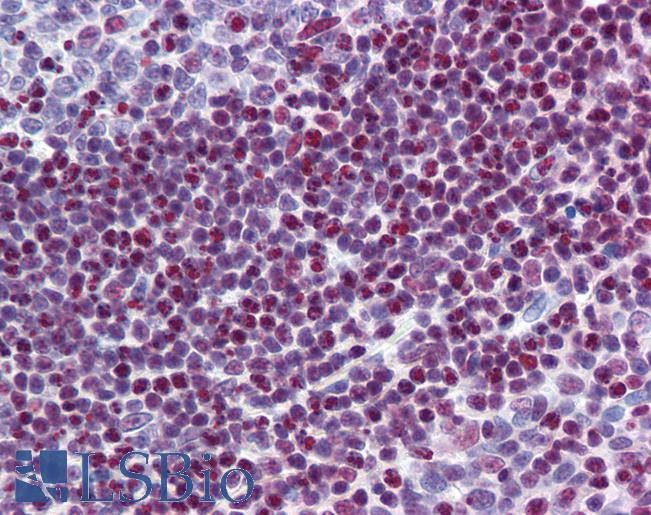 SRSF6 / SRP55 Antibody - Anti-SRSF6 / SFRS6 antibody IHC of human tonsil. Immunohistochemistry of formalin-fixed, paraffin-embedded tissue after heat-induced antigen retrieval. Antibody concentration 5 ug/ml.  This image was taken for the unconjugated form of this product. Other forms have not been tested.