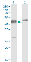 SRSF6 / SRP55 Antibody - Western blot of SFRS6 expression in transfected 293T cell line by SFRS6 monoclonal antibody (M02), clone 5G6.