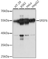 SRSF6 / SRP55 Antibody - Western blot analysis of extracts of various cell lines, using SRSF6 antibody at 1:1000 dilution. The secondary antibody used was an HRP Goat Anti-Rabbit IgG (H+L) at 1:10000 dilution. Lysates were loaded 25ug per lane and 3% nonfat dry milk in TBST was used for blocking. An ECL Kit was used for detection and the exposure time was 90s.