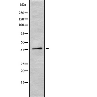 SRSF6 / SRP55 Antibody - Western blot analysis SFRS6 using HT29 whole cells lysates