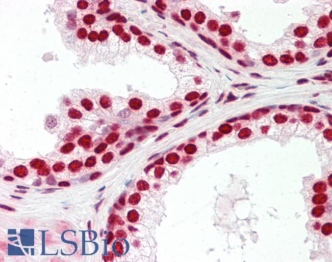 SRSF8 Antibody - Human Prostate: Formalin-Fixed, Paraffin-Embedded (FFPE).  This image was taken for the unconjugated form of this product. Other forms have not been tested.
