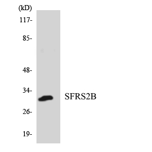 SRSF8 Antibody - Western blot analysis of the lysates from HepG2 cells using SFRS2B antibody.