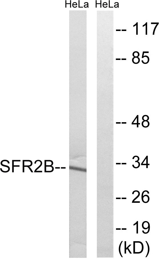 SRSF8 Antibody - Western blot analysis of lysates from HeLa cells, using SFRS2B Antibody. The lane on the right is blocked with the synthesized peptide.
