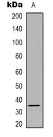 SRSF8 Antibody - Western blot analysis of SRSF8 expression in HeLa (A) whole cell lysates.