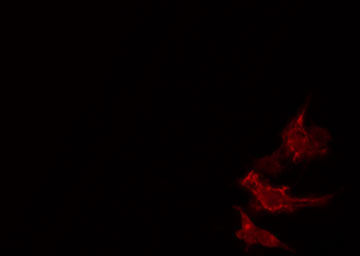 SRSF8 Antibody - Staining HeLa cells by IF/ICC. The samples were fixed with PFA and permeabilized in 0.1% Triton X-100, then blocked in 10% serum for 45 min at 25°C. The primary antibody was diluted at 1:200 and incubated with the sample for 1 hour at 37°C. An Alexa Fluor 594 conjugated goat anti-rabbit IgG (H+L) antibody, diluted at 1/600, was used as secondary antibody.