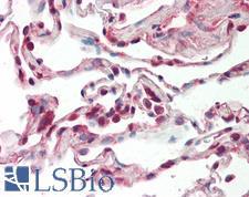 SRSF9 / SFRS9 Antibody - Anti-SRSF9 / SFRS9 antibody IHC staining of human lung. Immunohistochemistry of formalin-fixed, paraffin-embedded tissue after heat-induced antigen retrieval. Antibody concentration 10 ug/ml.  This image was taken for the unconjugated form of this product. Other forms have not been tested.