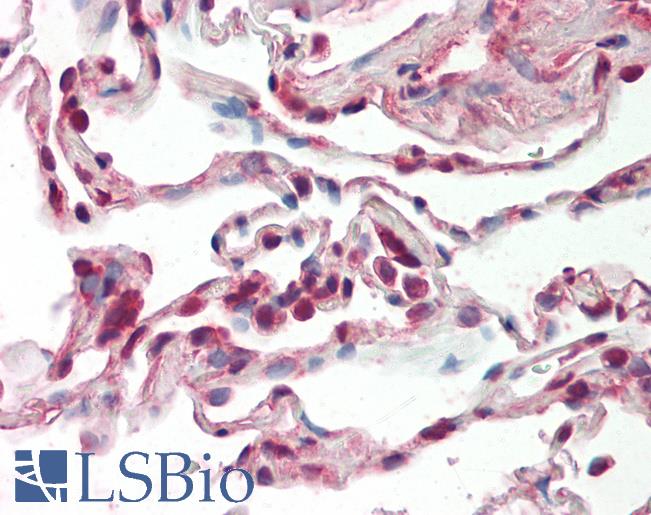SRSF9 / SFRS9 Antibody - Anti-SRSF9 / SFRS9 antibody IHC staining of human lung. Immunohistochemistry of formalin-fixed, paraffin-embedded tissue after heat-induced antigen retrieval. Antibody concentration 10 ug/ml.  This image was taken for the unconjugated form of this product. Other forms have not been tested.