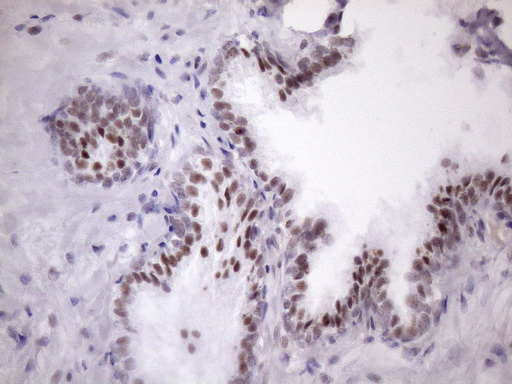 SRSF9 / SFRS9 Antibody - IHC of paraffin-embedded Human prostate tissue using anti-SRSF9 mouse monoclonal antibody. (Heat-induced epitope retrieval by Tris-EDTA, pH8.0)(1:150).