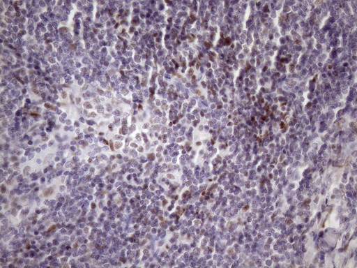 SRSF9 / SFRS9 Antibody - IHC of paraffin-embedded Human lymph node tissue using anti-SRSF9 mouse monoclonal antibody. (Heat-induced epitope retrieval by Tris-EDTA, pH8.0)(1:150).