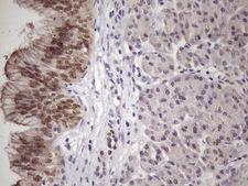 SRSF9 / SFRS9 Antibody - Immunohistochemical staining of paraffin-embedded Human pancreas tissue within the normal limits using anti-SRSF9 mouse monoclonal antibody. (Heat-induced epitope retrieval by 1 mM EDTA in 10mM Tris, pH8.5, 120C for 3min. (1:150)
