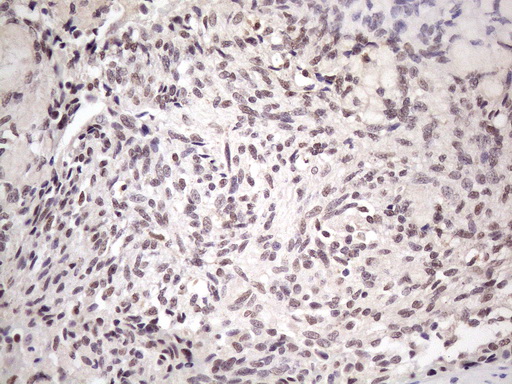 SRSF9 / SFRS9 Antibody - IHC of paraffin-embedded Human thyroid tissue using anti-SRSF9 mouse monoclonal antibody. (Heat-induced epitope retrieval by 1 mM EDTA in 10mM Tris, pH8.5, 120°C for 3min)(1:150).