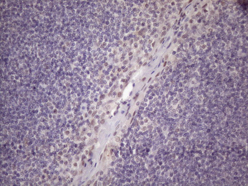 SRSF9 / SFRS9 Antibody - IHC of paraffin-embedded Human tonsil using anti-SRSF9 mouse monoclonal antibody. (Heat-induced epitope retrieval by 1 mM EDTA in 10mM Tris, pH8.5, 120°C for 3min)(1:150).