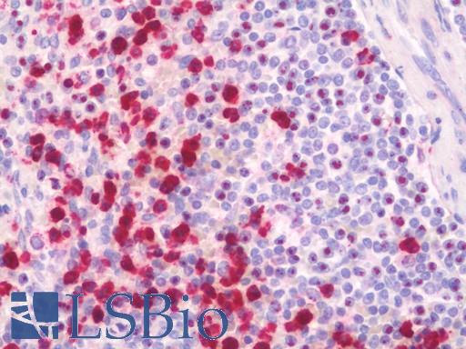 SRSF9 / SFRS9 Antibody - Anti-SRSF9 / SFRS9 antibody IHC staining of human spleen. Immunohistochemistry of formalin-fixed, paraffin-embedded tissue after heat-induced antigen retrieval. Antibody concentration 10 ug/ml.  This image was taken for the unconjugated form of this product. Other forms have not been tested.