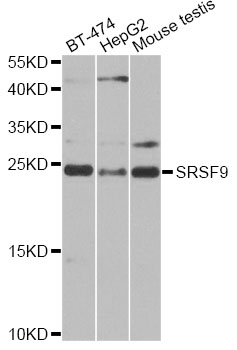 SRSF9 / SFRS9 Antibody - Western blot analysis of extracts of various cell lines, using SRSF9 antibody at 1:1000 dilution. The secondary antibody used was an HRP Goat Anti-Rabbit IgG (H+L) at 1:10000 dilution. Lysates were loaded 25ug per lane and 3% nonfat dry milk in TBST was used for blocking. An ECL Kit was used for detection and the exposure time was 30s.