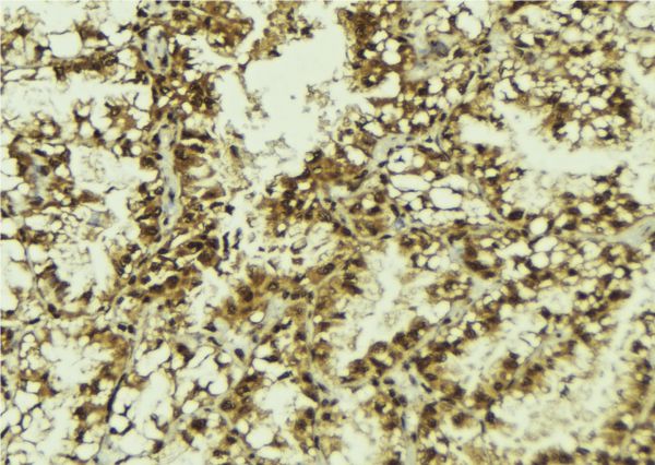 SRSF9 / SFRS9 Antibody - 1:100 staining human lung tissue by IHC-P. The sample was formaldehyde fixed and a heat mediated antigen retrieval step in citrate buffer was performed. The sample was then blocked and incubated with the antibody for 1.5 hours at 22°C. An HRP conjugated goat anti-rabbit antibody was used as the secondary.