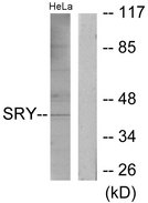SRY Antibody - Western blot analysis of lysates from HeLa cells, using SRY Antibody. The lane on the right is blocked with the synthesized peptide.