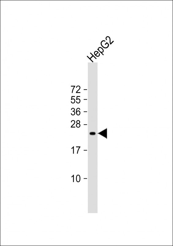 SRY Antibody - Anti-SRY Antibody (N-Term)at 1:2000 dilution + HepG2 whole cell lysates Lysates/proteins at 20 ug per lane. Secondary Goat Anti-Rabbit IgG, (H+L), Peroxidase conjugated at 1:10000 dilution. Predicted band size: 24 kDa. Blocking/Dilution buffer: 5% NFDM/TBST.
