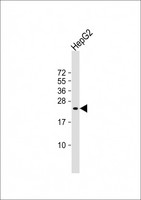 SRY Antibody - Anti-SRY Antibody (N-Term)at 1:2000 dilution + HepG2 whole cell lysates Lysates/proteins at 20 ug per lane. Secondary Goat Anti-Rabbit IgG, (H+L), Peroxidase conjugated at 1:10000 dilution. Predicted band size: 24 kDa. Blocking/Dilution buffer: 5% NFDM/TBST.