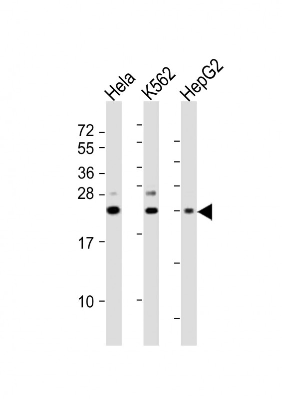 SRY Antibody - All lanes: Anti-SRY Antibody (N-Term) at 1:2000 dilution. Lane 1: HeLa whole cell lysates. Lane 2: K562 whole cell lysates. Lane 3: HepG2 whole cell lysates Lysates/proteins at 20 ug per lane. Secondary Goat Anti-Rabbit IgG, (H+L), Peroxidase conjugated at 1:10000 dilution Predicted band size: 24 kDa. Blocking/Dilution buffer: 5% NFDM/TBST.